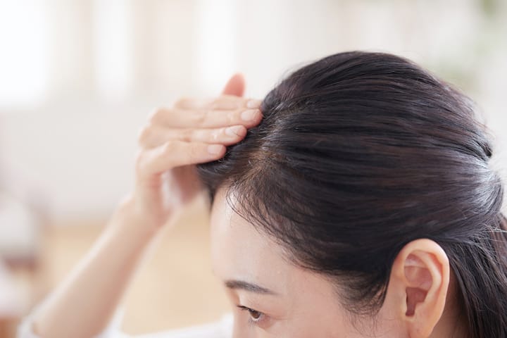 写真：頭皮を気にする女性